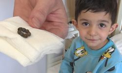 Ankara'da doktorları şaşırtan vaka